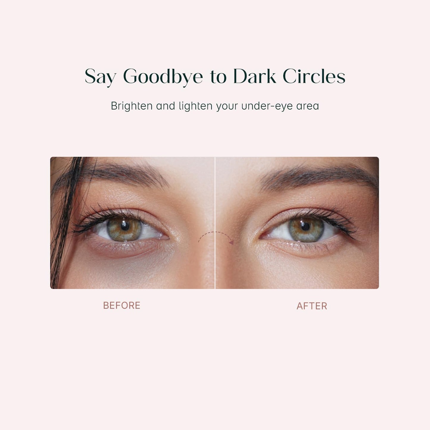 Korean Eye Patches for Dark Circles, Puffy Eyes, Hydrates & Repairs (32 Pcs)