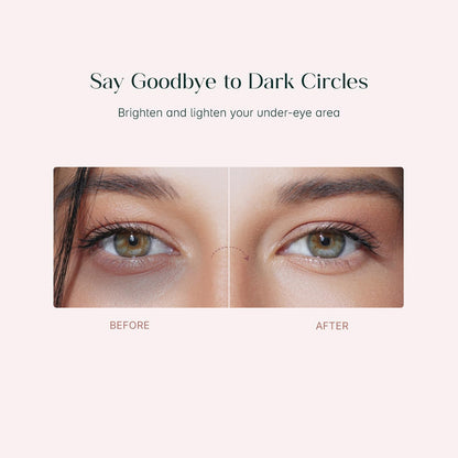 Korean Eye Patches for Dark Circles, Puffy Eyes, Hydrates & Repairs (32 Pcs)